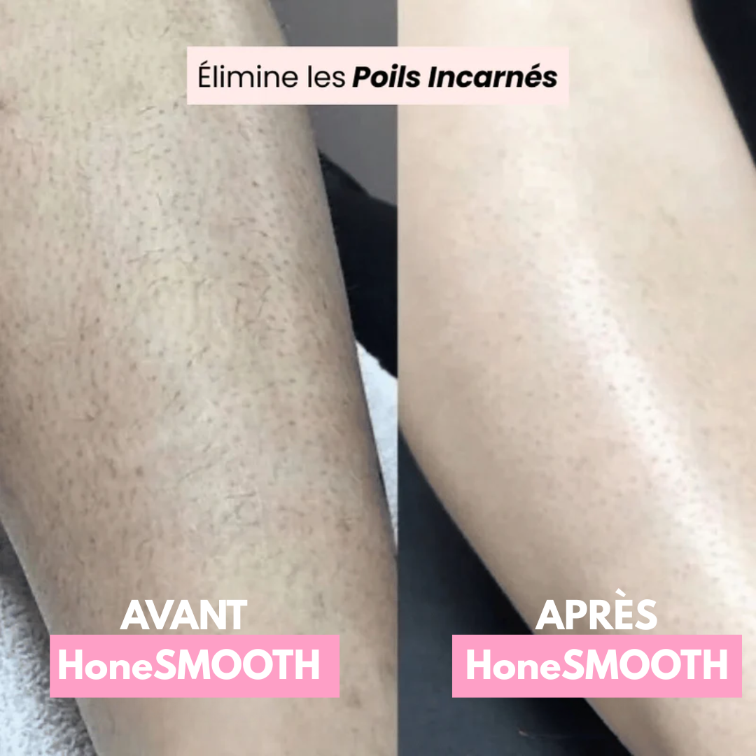 Rasoir Électrique Féminin 2-en-1 | HoneSMOOTH®