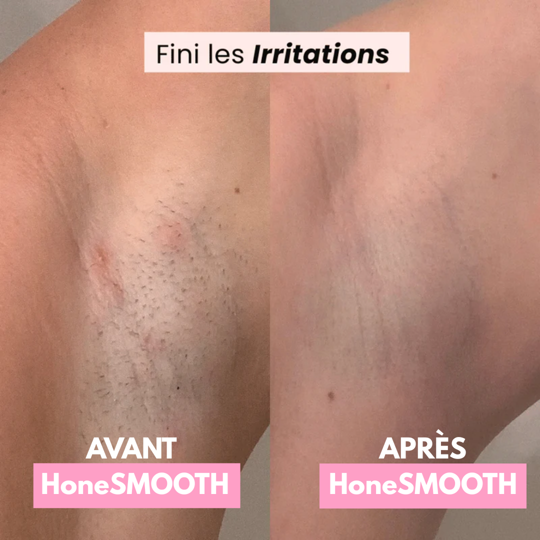 Rasoir Électrique Féminin 2-en-1 | HoneSMOOTH®