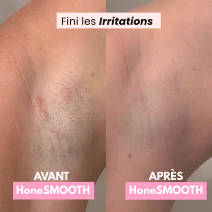 Rasoir Électrique Féminin 2-en-1 | HoneSMOOTH®
